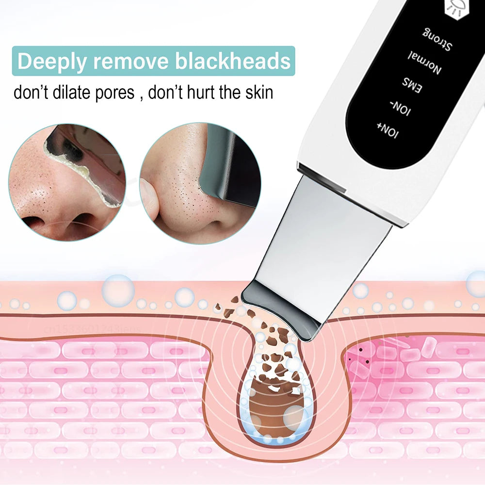 Ultrasonic Skin Scrubber Pore Cleaner