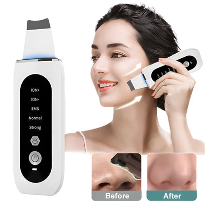 Ultrasonic Skin Scrubber Pore Cleaner