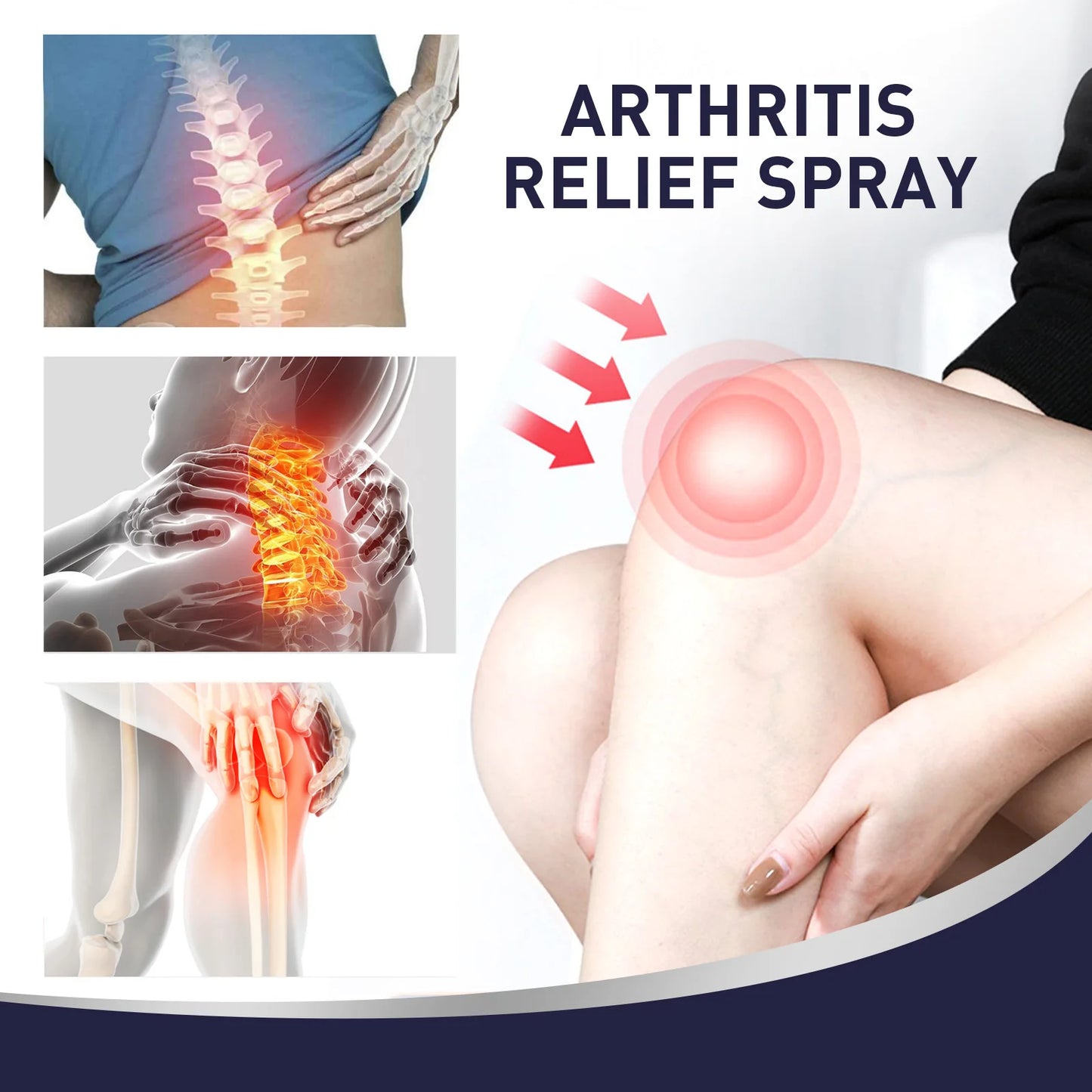 Knee Pain Relief Arthritis Spray