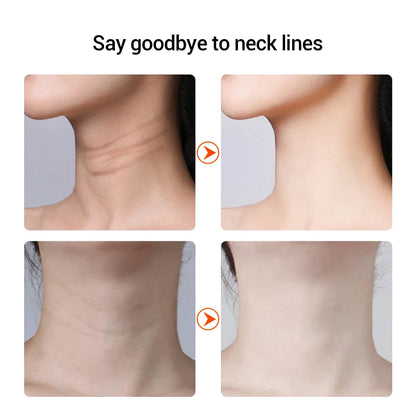 EMS Neck Face Lifting Device